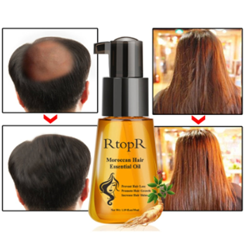 Anti-hair Loss Product Moroccan Hair Essential Oil 35ml